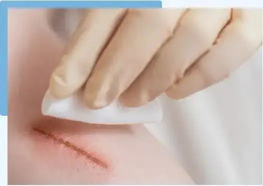 laceration