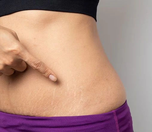 Scar gels and creams to reduce scar appearance, support healing, and improve skin texture and elasticity.