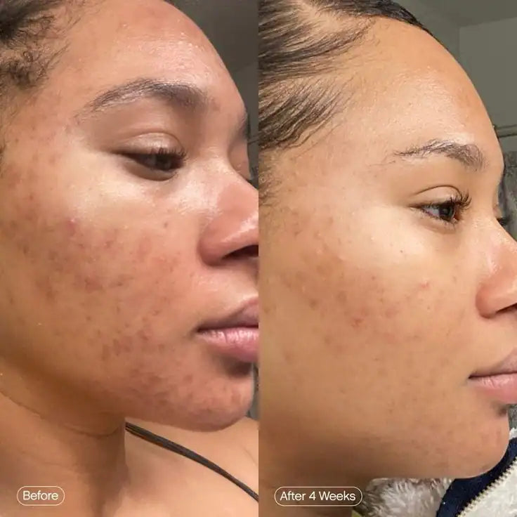 topical treatments and washes