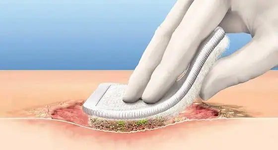 Autolytic Debridement