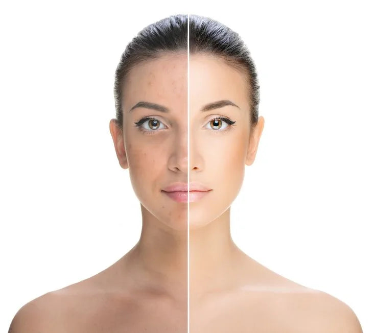 Pigmentation / Brightening
