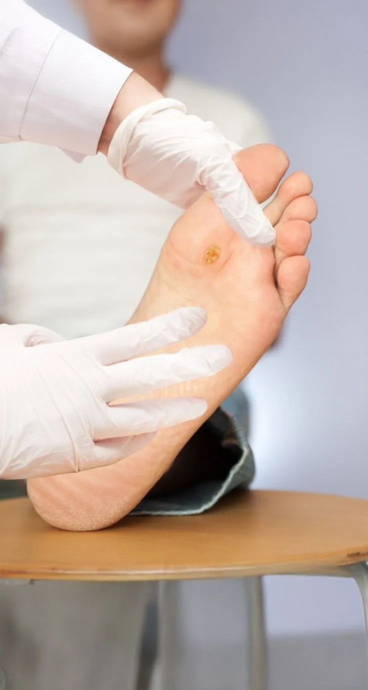 diabetic foot ulcer