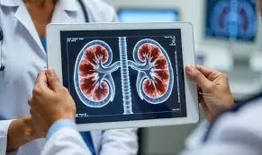 Kidney Care / Nephrology